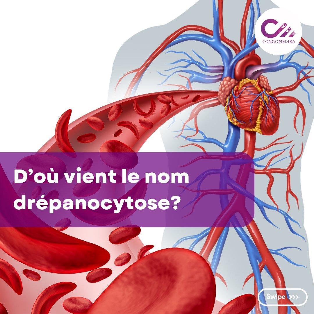 D’où vient la drépanocytose ? 