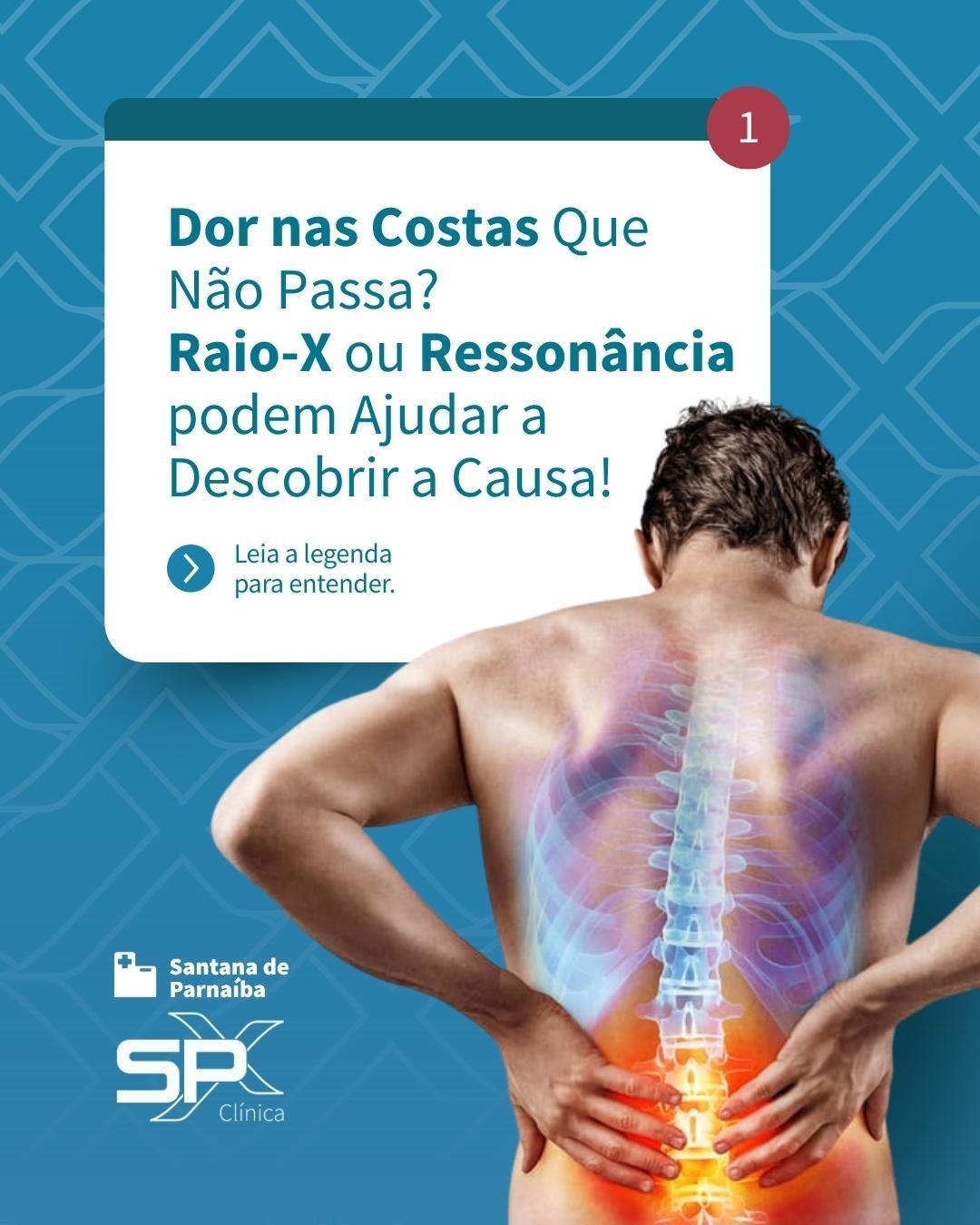 😖 Dor nas Costas Que Não Passa? Raio-X ou Ressonância podem Ajudar a Descobrir a Causa! 🔎