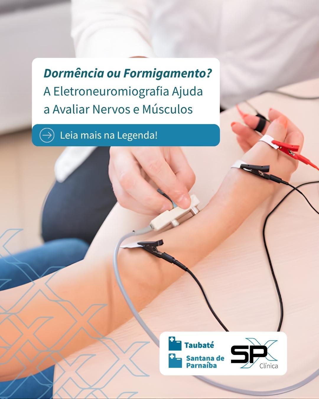 😖 Dormência ou Formigamento? A Eletroneuromiografia Ajuda a Avaliar Nervos e Músculos ⚡