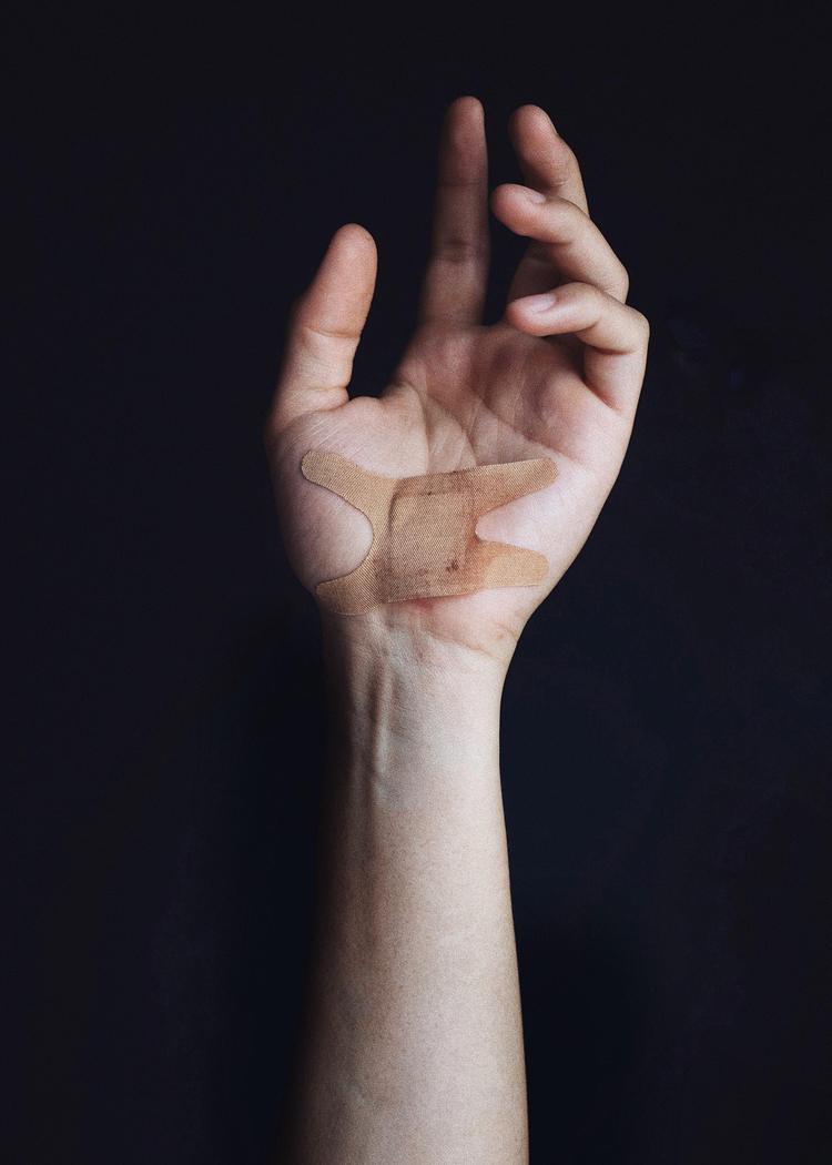  7. Wound or Scar