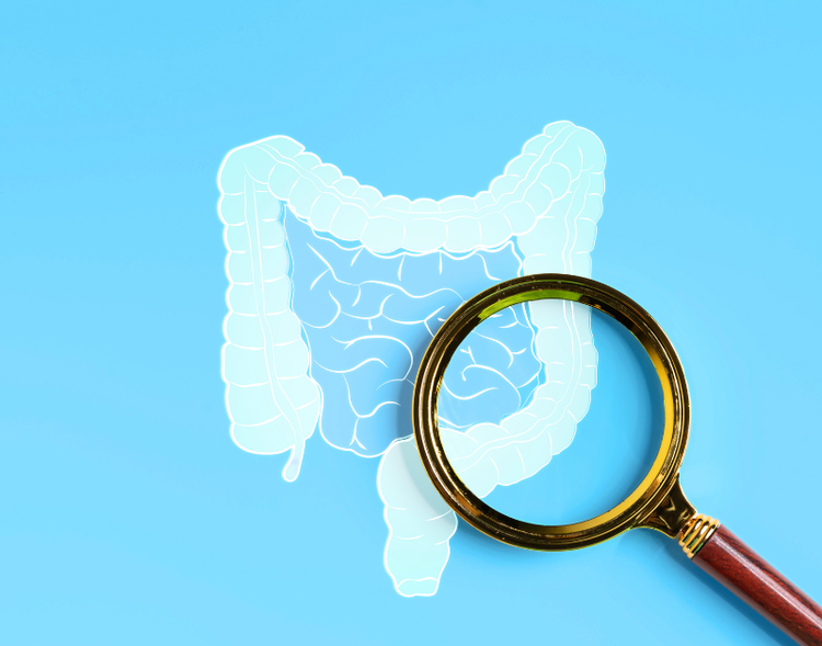 Screening colon-retto