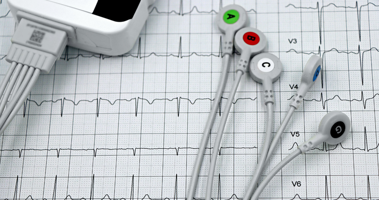 Holter ECG