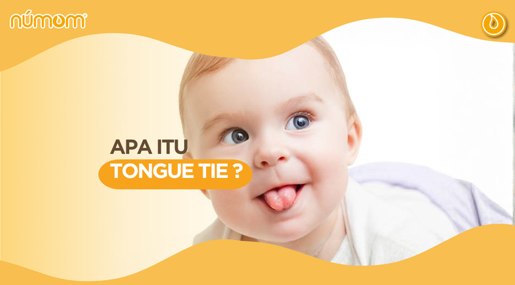 APA ITU TONGUE TIE ?