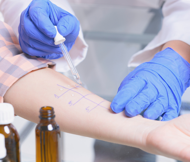 Test allergie inalanti/alimenti