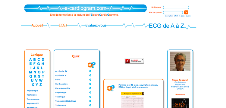 E-Cardiogram