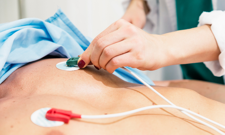 ECG