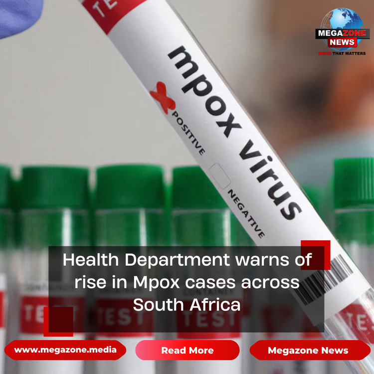 Health Department warns of rise in Mpox cases across South Africa