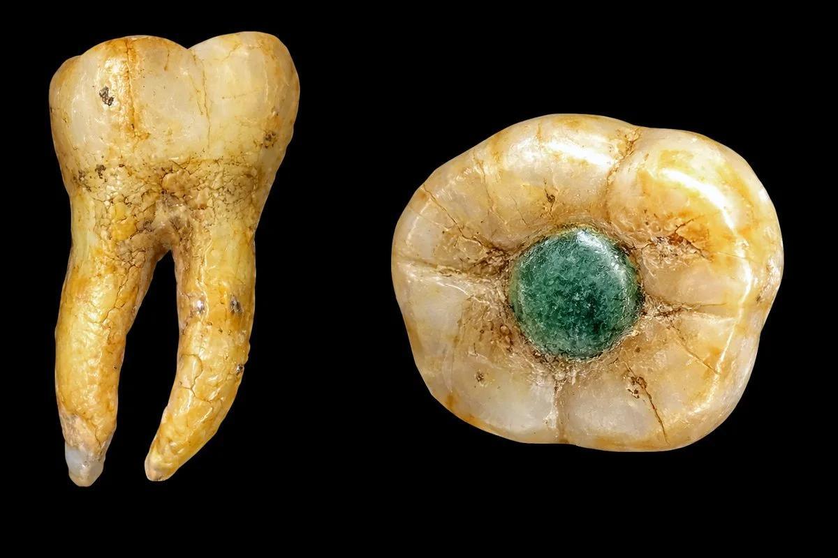 Jade set in molar raises new questions about Maya dental practice
