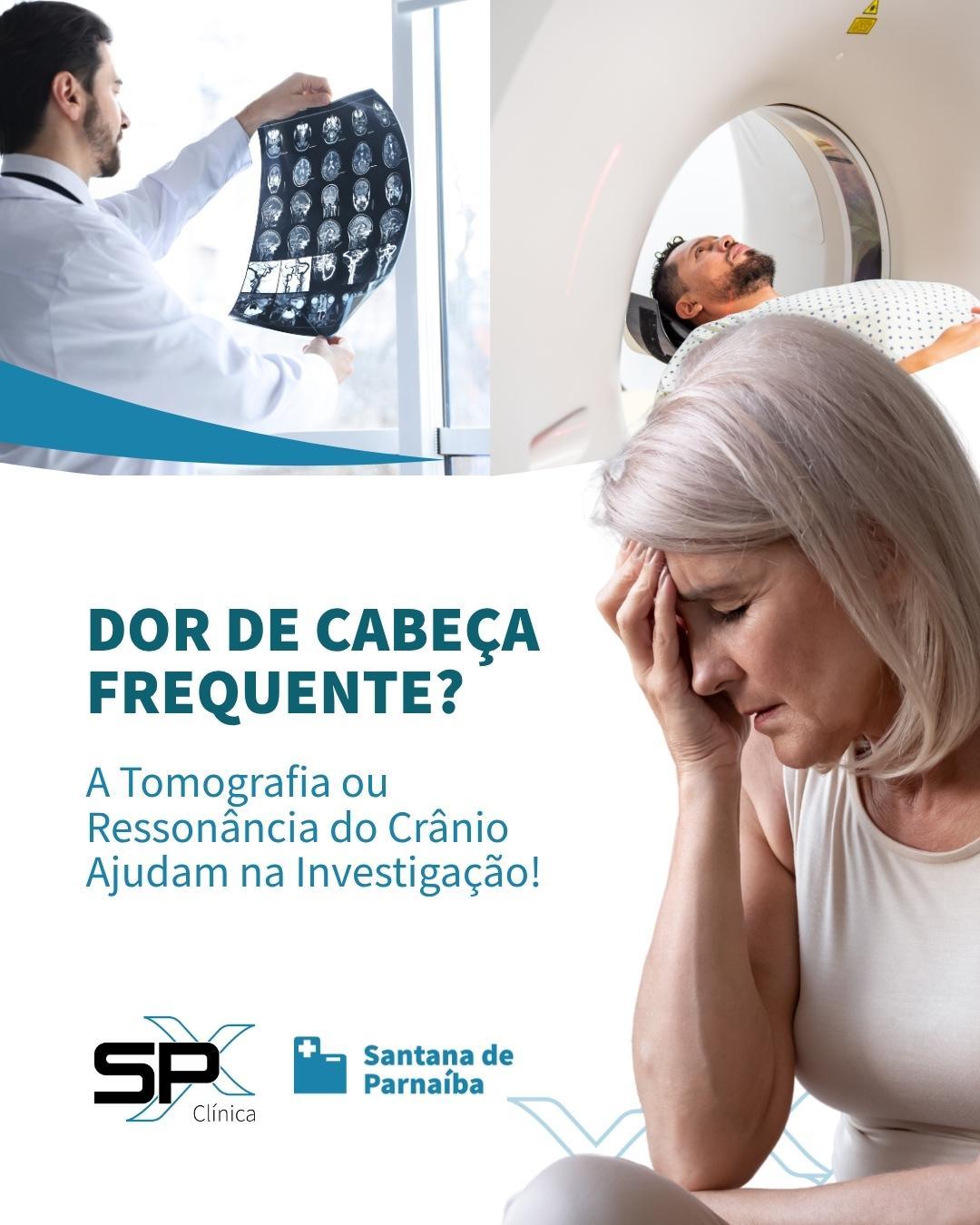 🤯 Dor de Cabeça Frequente? A Tomografia ou Ressonância do Crânio Ajudam na Investigação! 🙏🏻