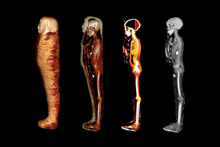 CT SCAN REVEALS 49 AMULETS IN ANCIENT EGYPTIAN MUMMY