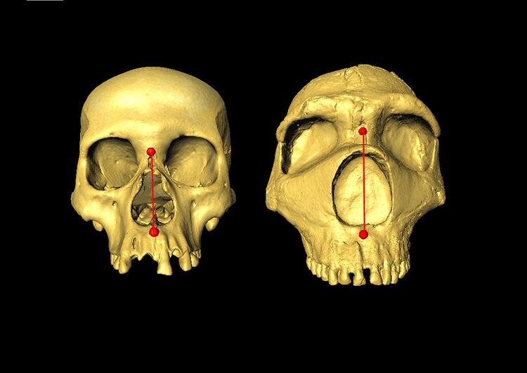 STUDY FINDS THAT NOSE SHAPE GENE IS INHERITED FROM NEANDERTHALS