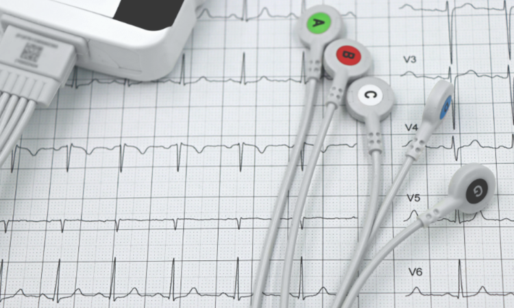 Holter cardiaco