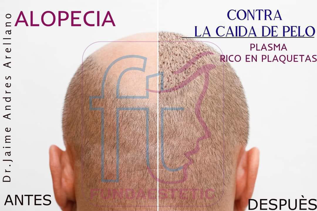 Dr. Jaime Andrés Arellano. Dr. Jaime Andrés Arellano.