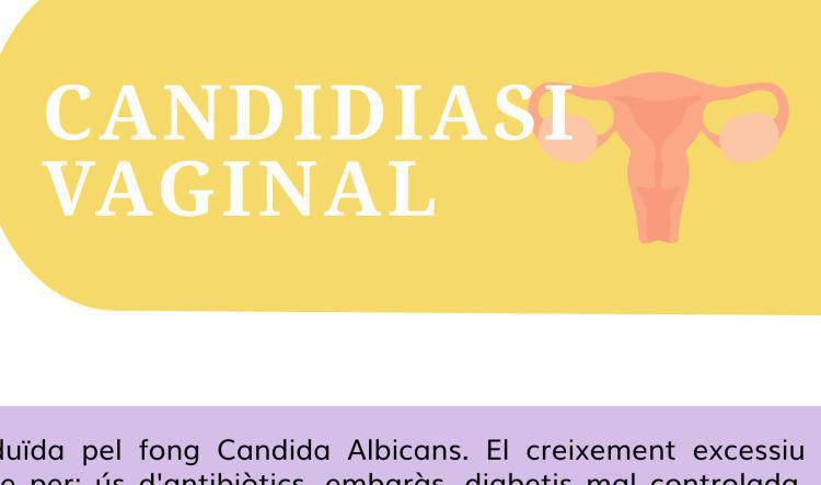 Candidiasi vaginal
