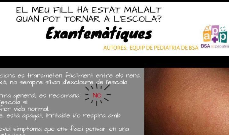 té una malaltia exantemàtica ?