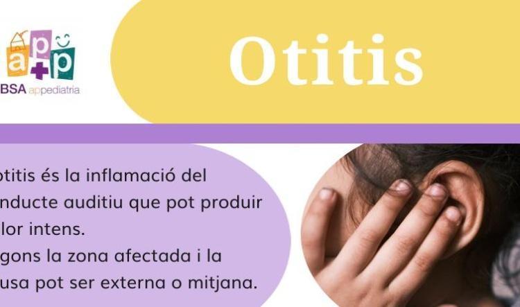 té Otitis