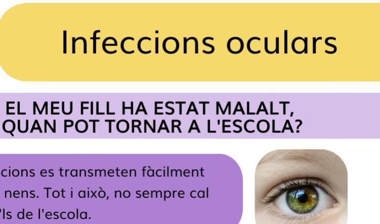 té una infecció ocular ?