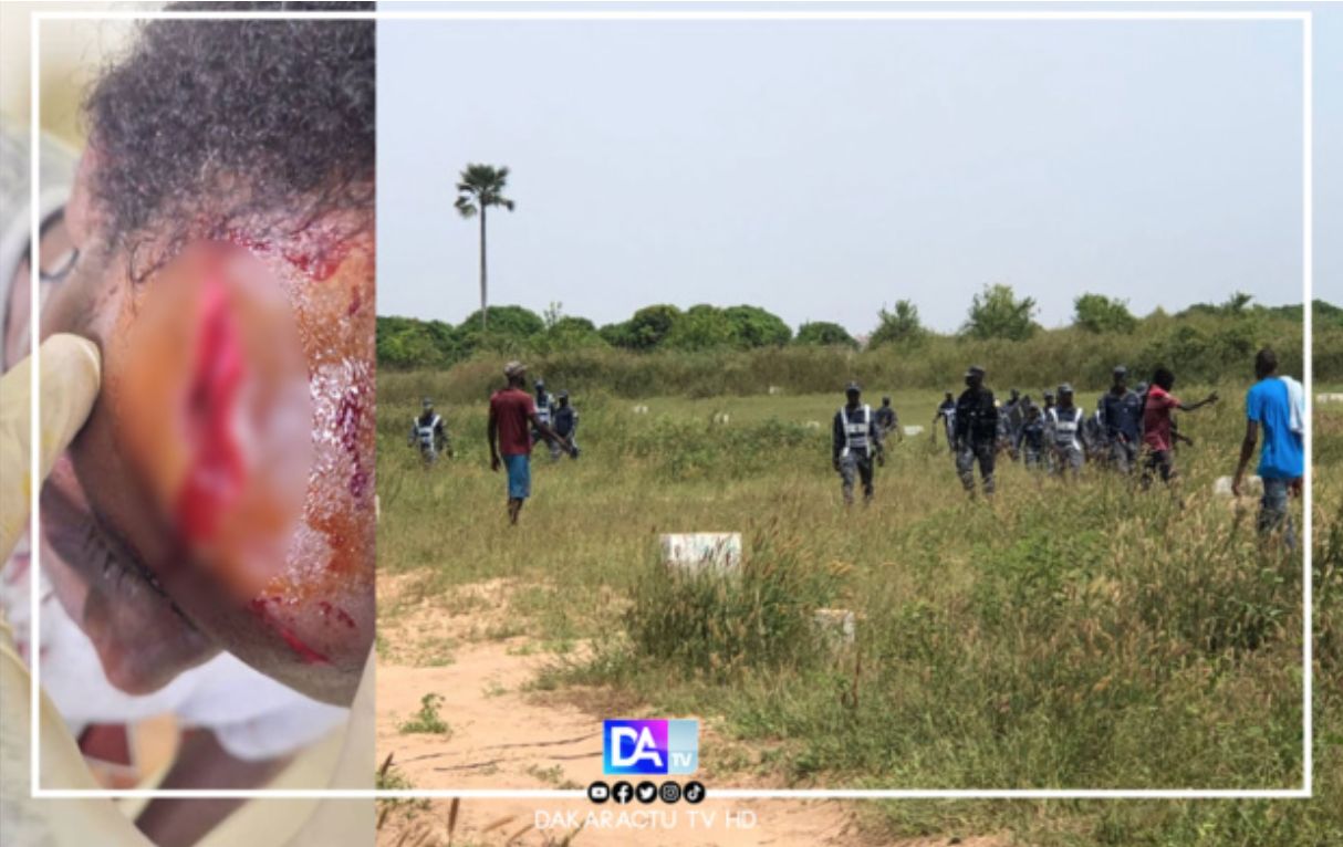Litige foncier à Mbeye/violents affrontements en FDS et populations: des arrestations et des blessés graves, la mairie de Bambilor saccagée
