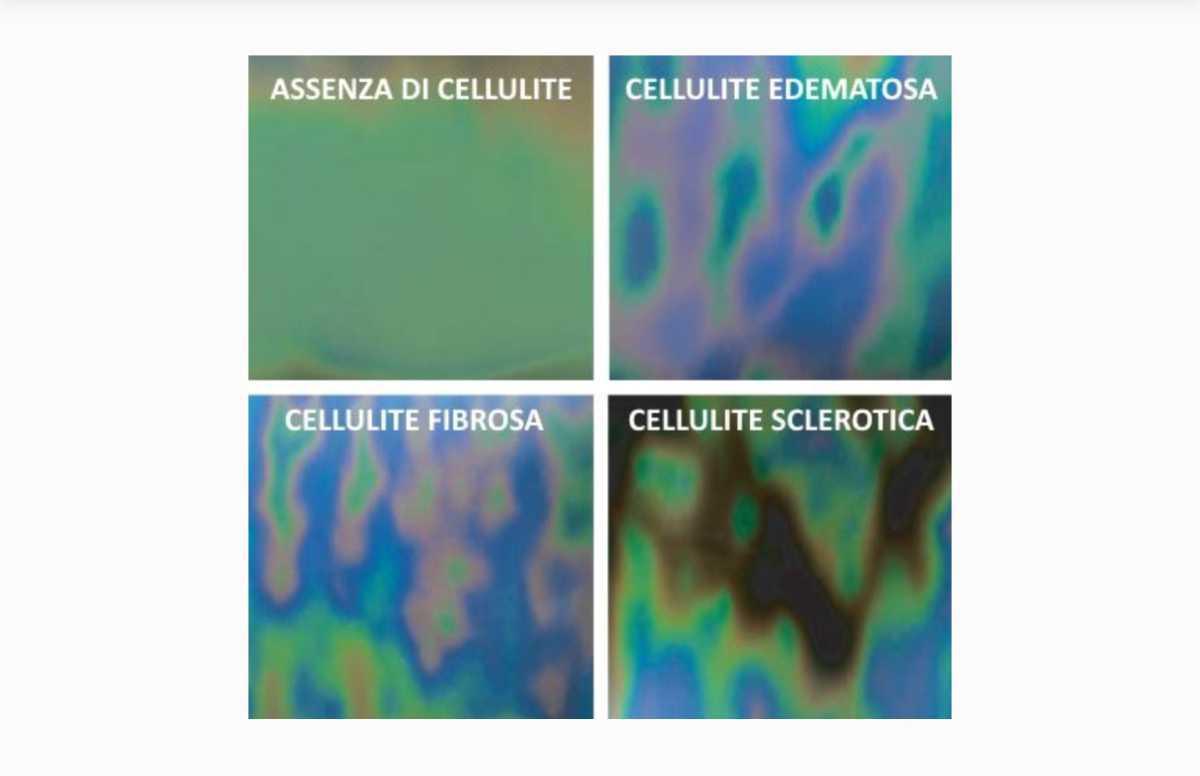 Appuntamento con Bionike