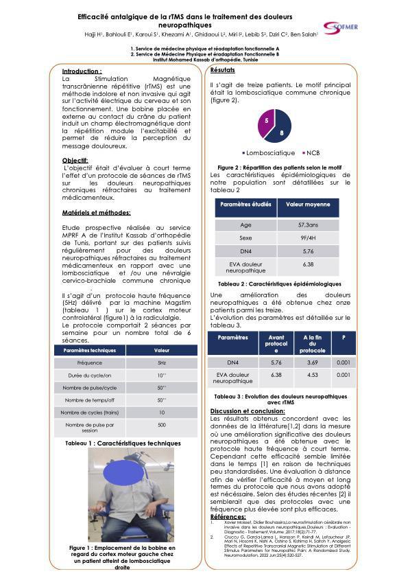 rTMS dans les douleurs neuropathiques