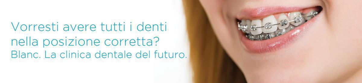 Ortodonzia Tradizionale Ortodonzia Tradizionale