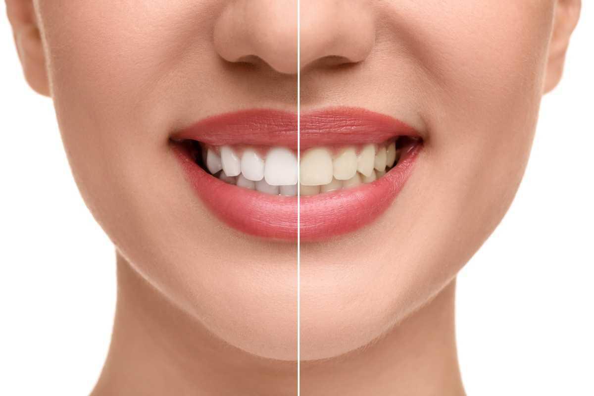 Prenota subito e sorridi con noi!