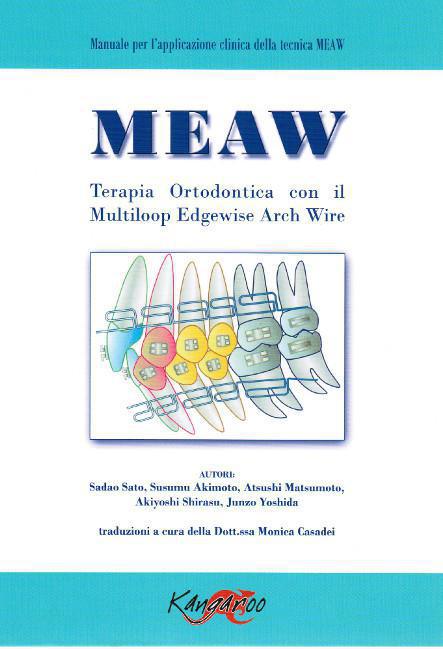 Meaw. Terapia Ortodontica Con Il Multiloop Edgewise Arch Wire