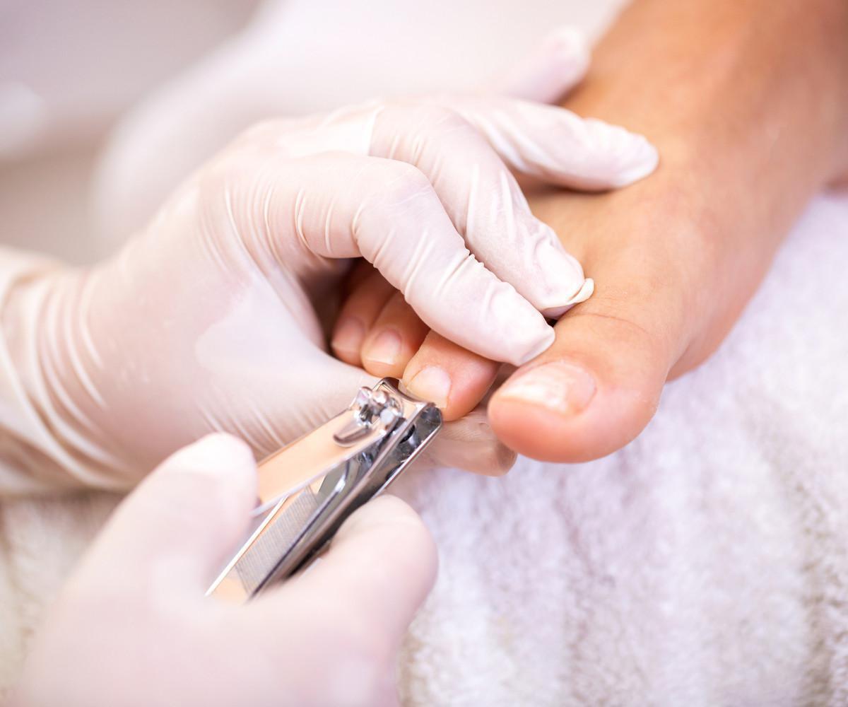 Visita pedicure curativa 