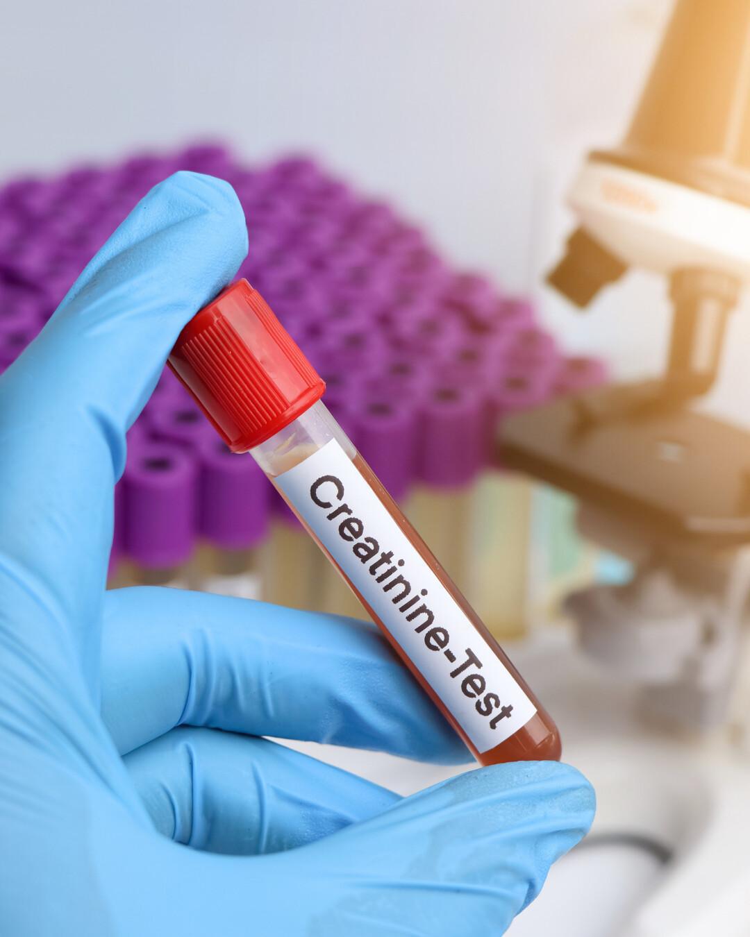 Misurazione creatinina Misurazione creatinina