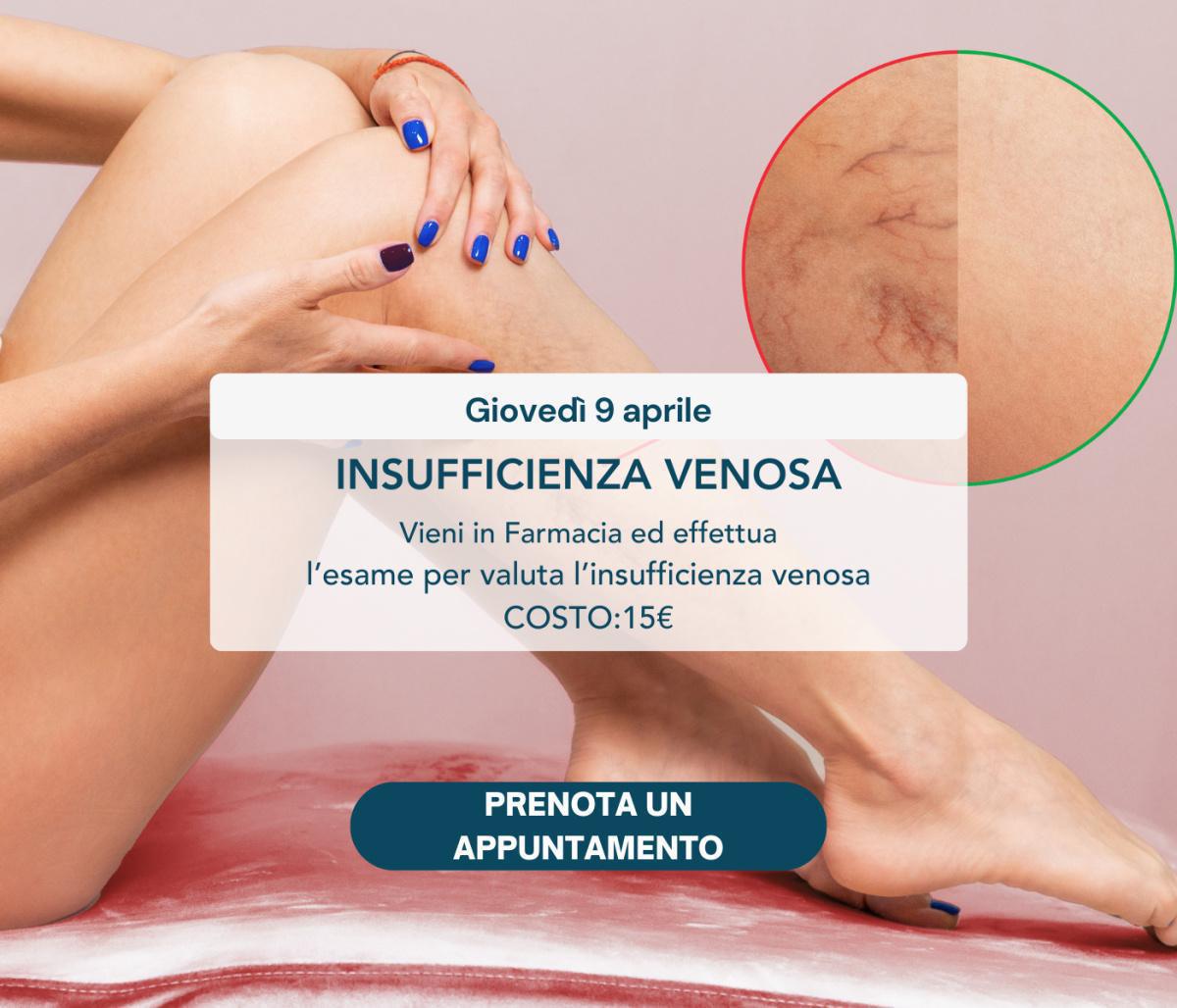 Giornata dell'Insufficienza venosa