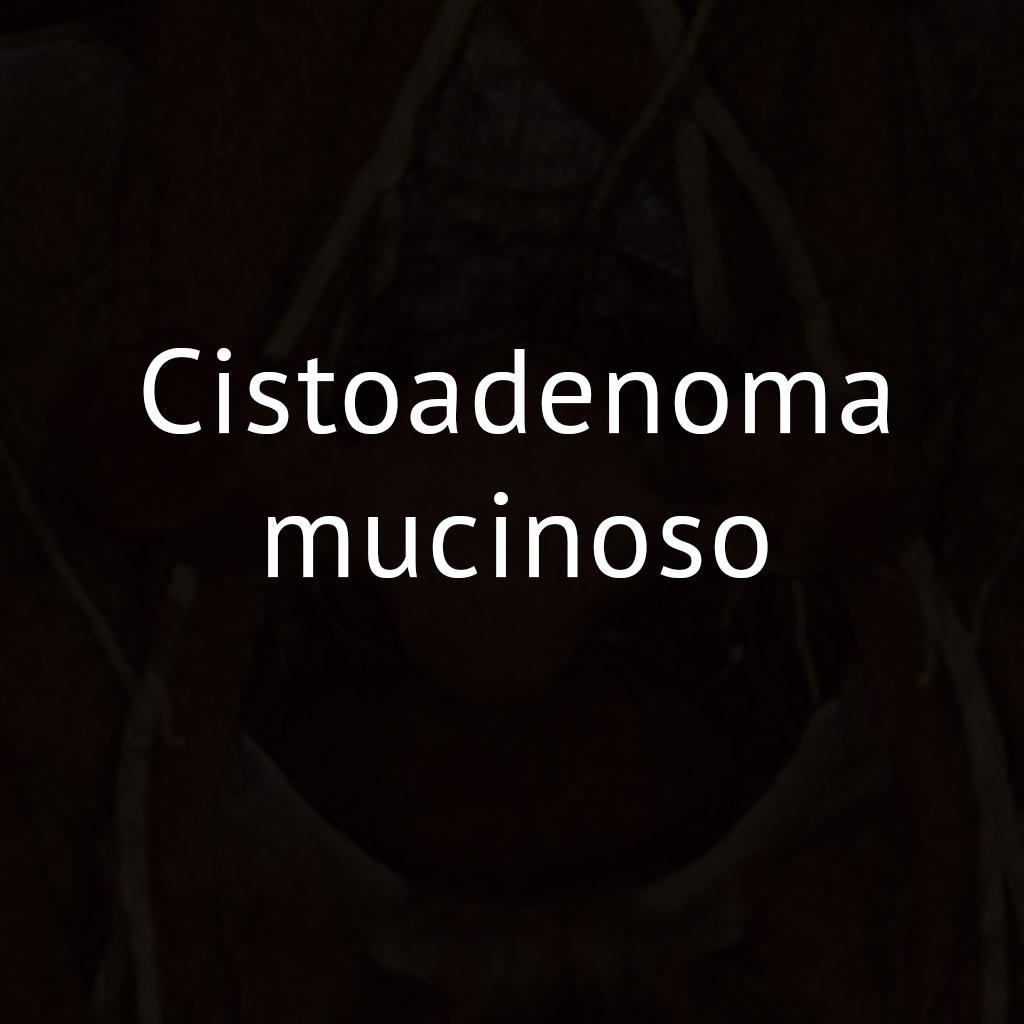 Cistoadenoma mucinoso