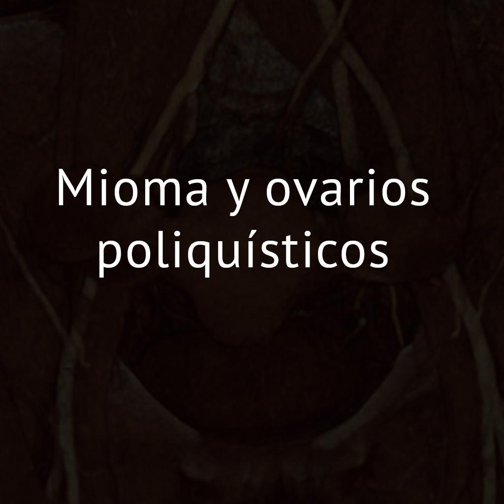Mioma y ovarios poliquísticos