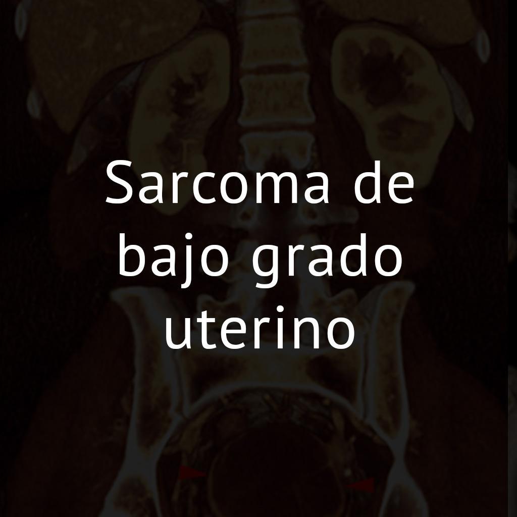 Sarcoma de bajo grado uterino