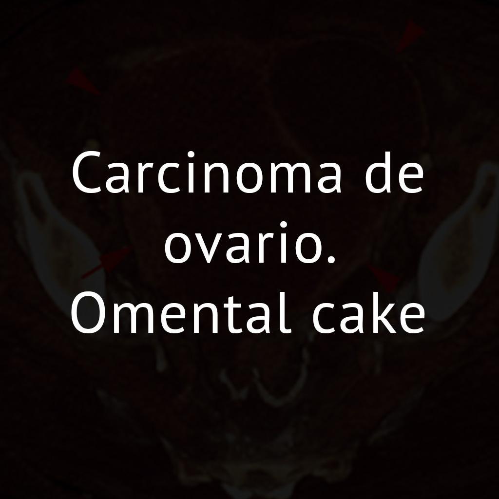 Carcinoma de ovario. Omental cake