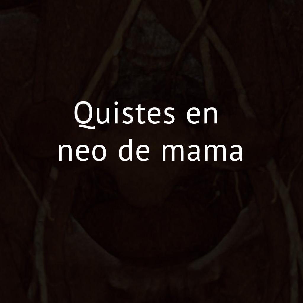 Quistes en neo de mama