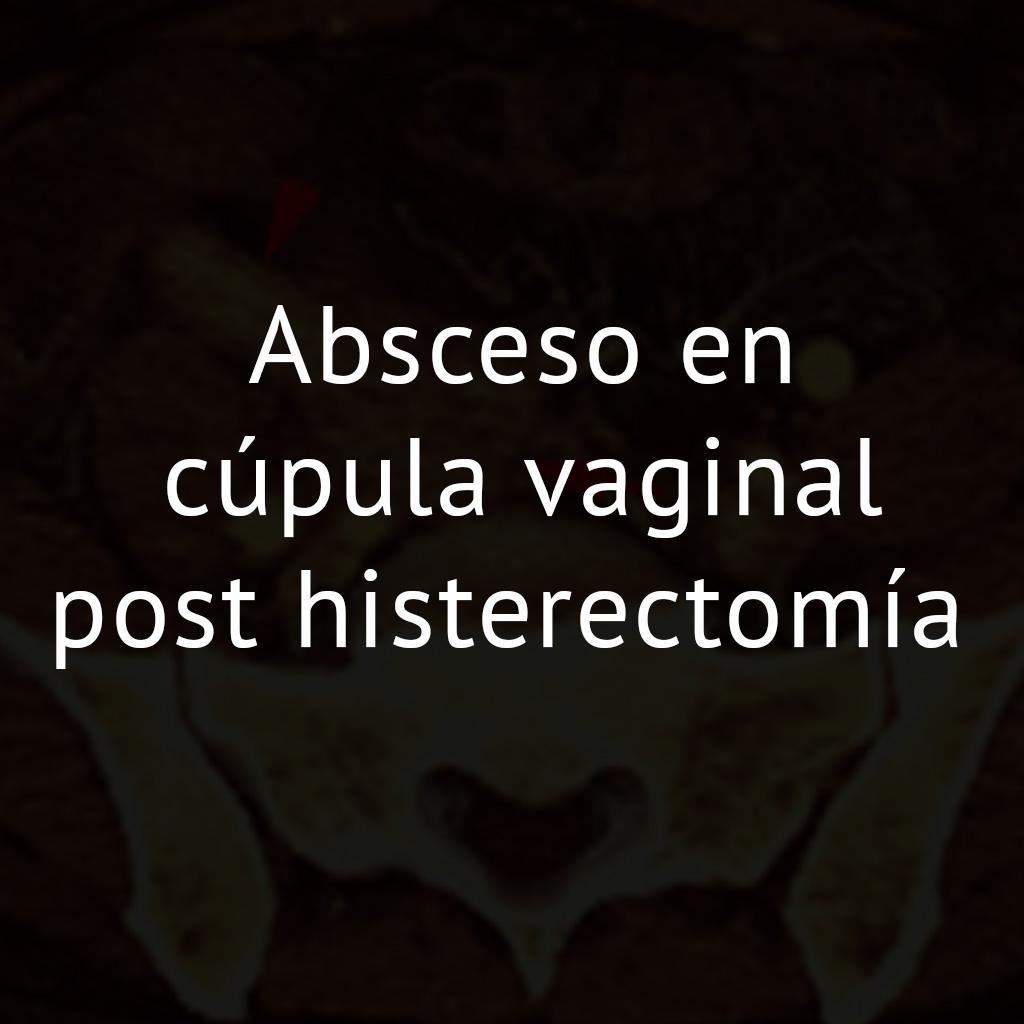Absceso en cúpula vaginal post histerectomía