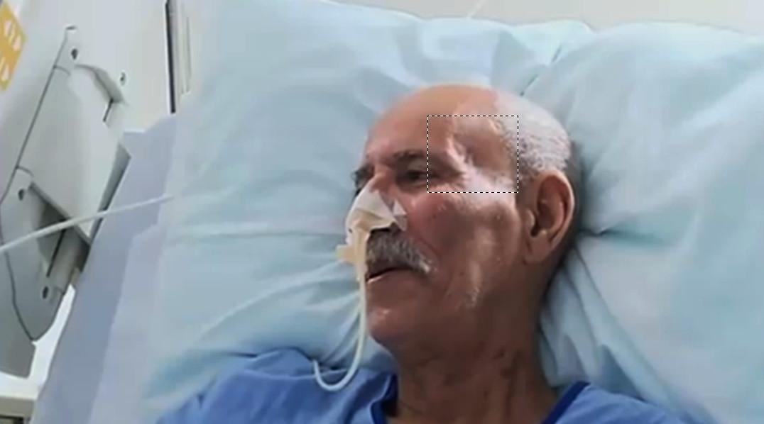 زعيم مرتزقة البوليساريو لم يصب بكورونا وهذا هو السبب الحقيقي وراء علاجه في إسبانيا