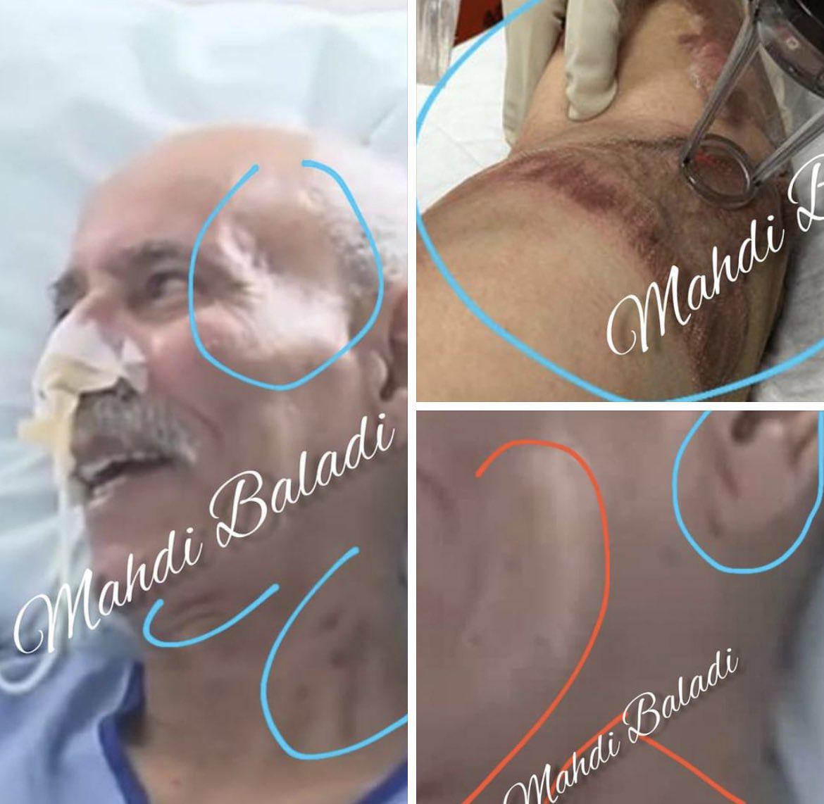 زعيم مرتزقة البوليساريو لم يصب بكورونا وهذا هو السبب الحقيقي وراء علاجه في إسبانيا