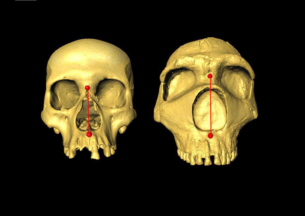 Study finds that nose shape gene is inherited from neanderthals