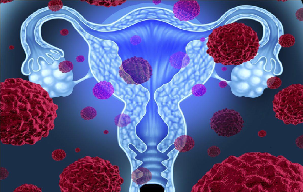 Virus del Papiloma Humano