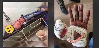 AFFAIRE VOL AVEC ARME A FEU A MALIKA : Le lutteur sort indemne de son agression par balle