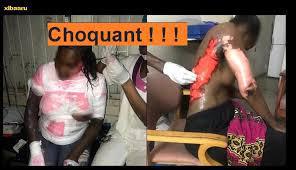 HORREUR A TOUBA THIAROYE : Alimatou Diallo tuée par ébouillantement par sa colocataire