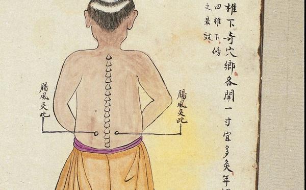 L’ACUPUNCTURE, LES VENTOUSES, LA MOXIBUSTION, LE MASSAGE THÉRAPEUTIQUE ET LE BADUANJIN : La médecine traditionnelle chinoise s’invite au plateau médical