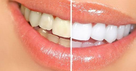 Odontologia Integrada - Dr. Wagner Becker & Dra. Laís Bongiorni Odontologia Integrada - Dr. Wagner Becker & Dra. Laís Bongiorni