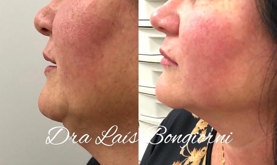 Odontologia Integrada - Dr. Wagner Becker & Dra. Laís Bongiorni Odontologia Integrada - Dr. Wagner Becker & Dra. Laís Bongiorni