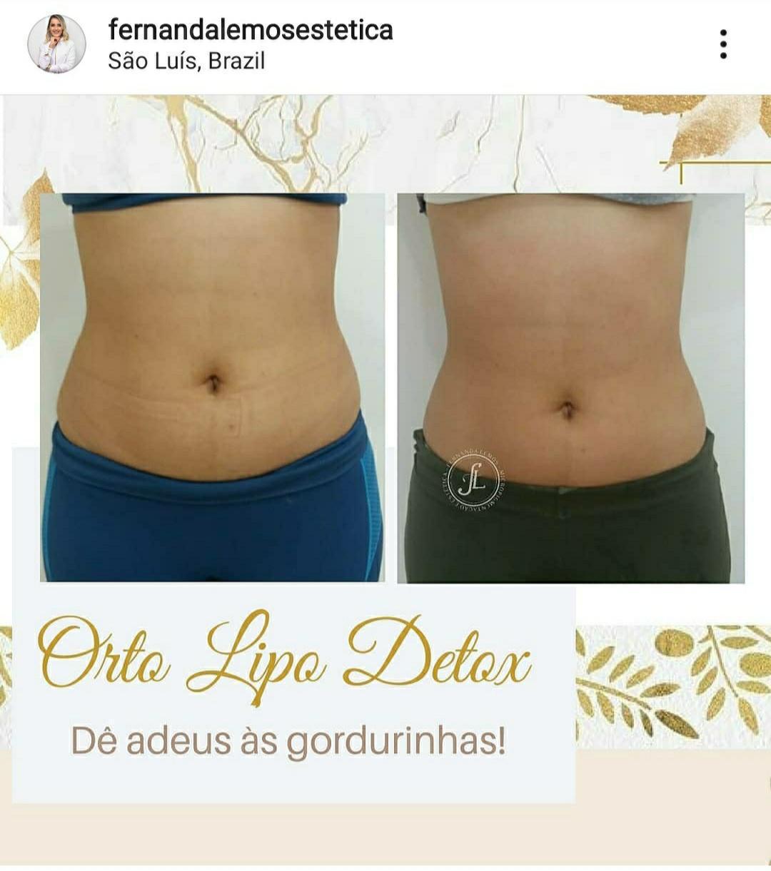 Fernanda Lemos Micropigmentação e Estética Fernanda Lemos Micropigmentação e Estética