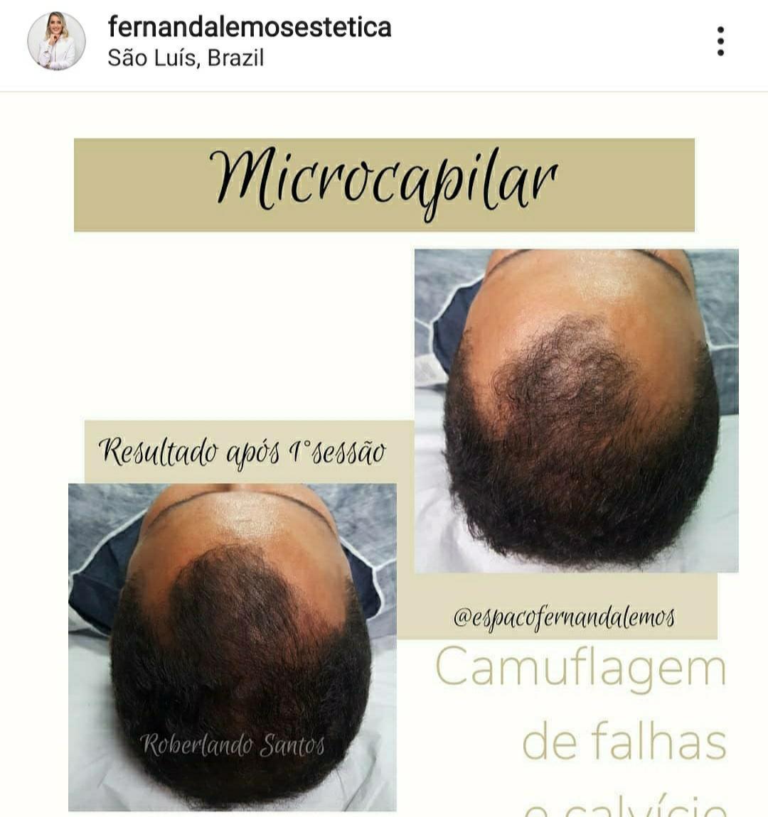 Fernanda Lemos Micropigmentação e Estética Fernanda Lemos Micropigmentação e Estética