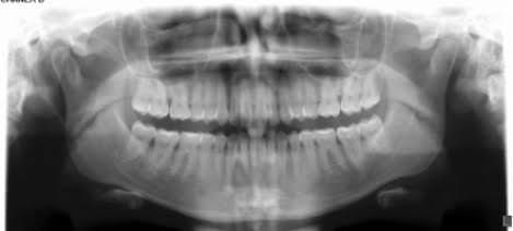 Odontoclin