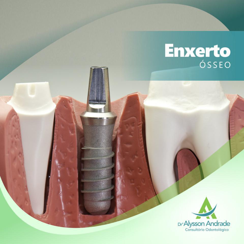 Dr Alysson Andrade Dr Alysson Andrade