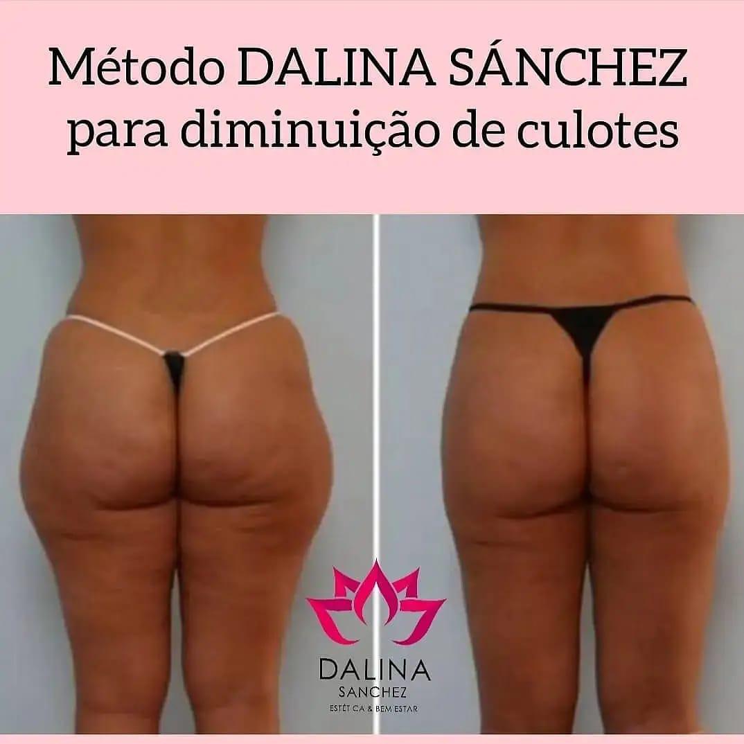 Estética Dalina Sanchez